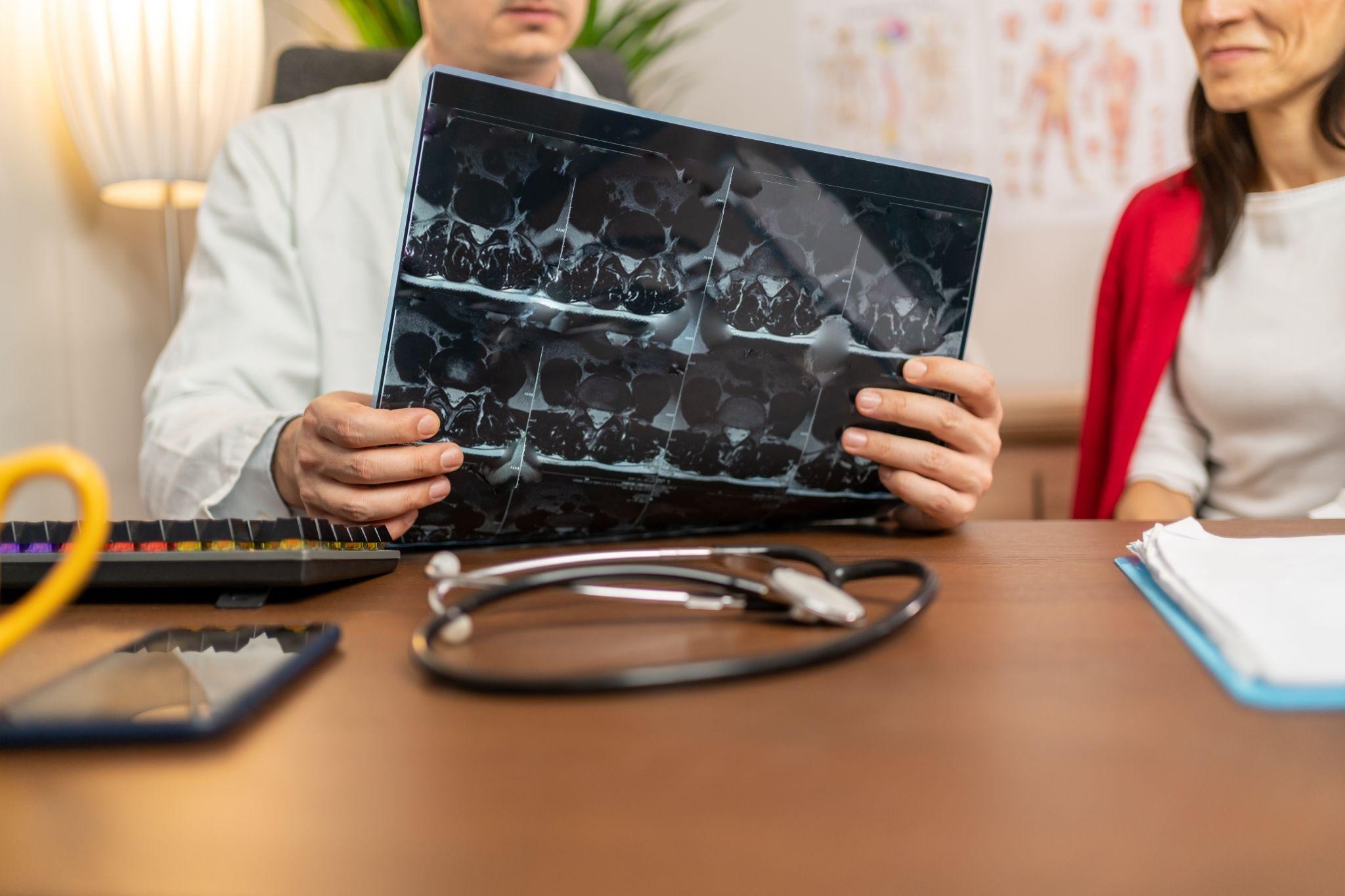 The “Brain Tune Up!” Approach to Treatment The "Brain Tune Up!" Approach to Multiple Sclerosis Treatment